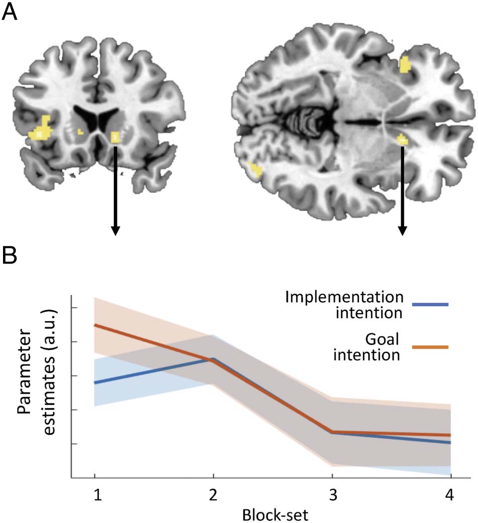 Can the Brain Strategically Go on Automatic Pilot? image