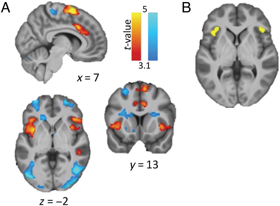 Can the Brain Strategically Go on Automatic Pilot? image