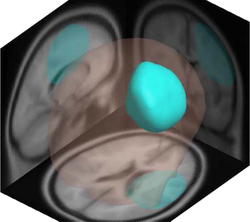 Stimulus Onset Asynchrony Affects Weighting-related image