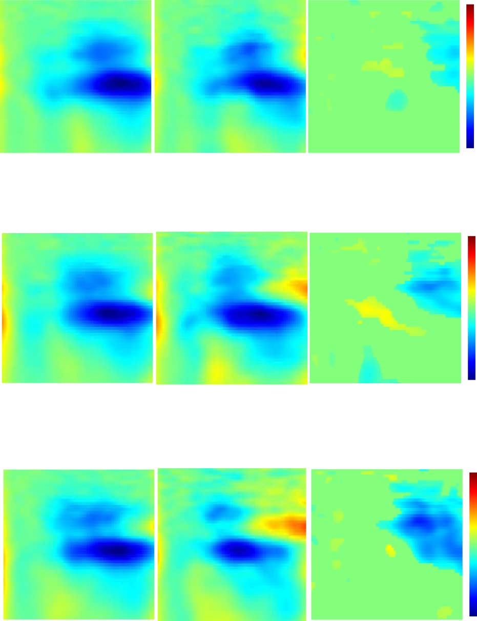 Stimulus Onset Asynchrony Affects Weighting-related image