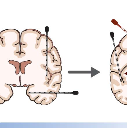 imagen de INVESTIGACIÓN