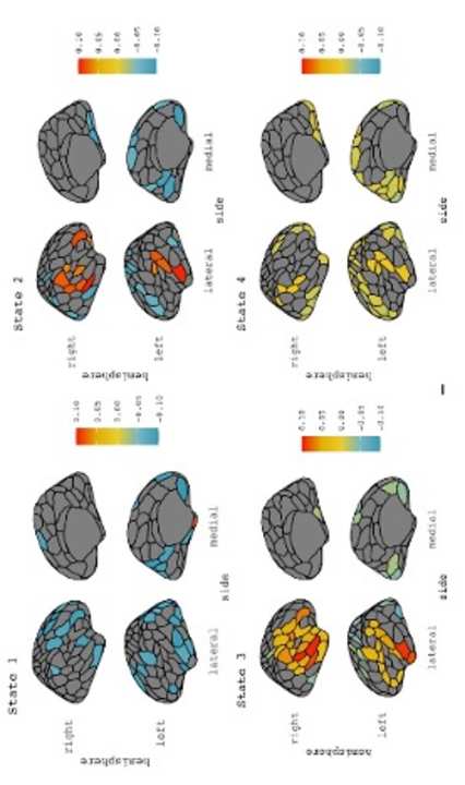 Faber, S.E.M., Belden, A.G., Loui, P。, & McInsosh, 右. (2023). Age-related variability in network engagement during music image