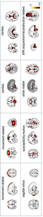 Song, L., Ren, Y., Shuhan, X., Hou, Y. & Er, X. (2023). A hybrid spatio-temporal deep belief network and sparse image