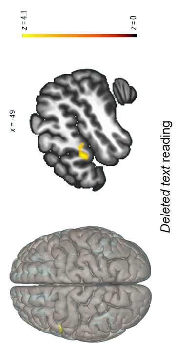 Taran, N。, Farah, R。, Gashri, C。, Gitman, E., Rosch, K., 施拉加尔, B.L. & Horowitz-Kraus, 时间. (2023). Executive functions- 图像