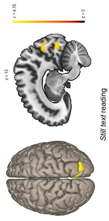 Taran, N。, Farah, R。, Gashri, C。, Gitman, E., Rosch, K., 施拉加尔, B.L. & Horowitz-Kraus, 时间. (2023). Executive functions- 图像