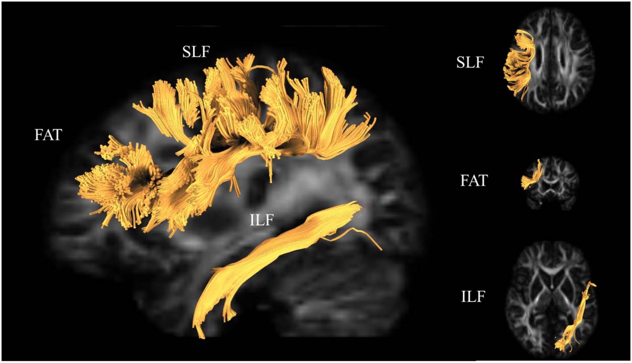 RESEARCH ARTICLE image