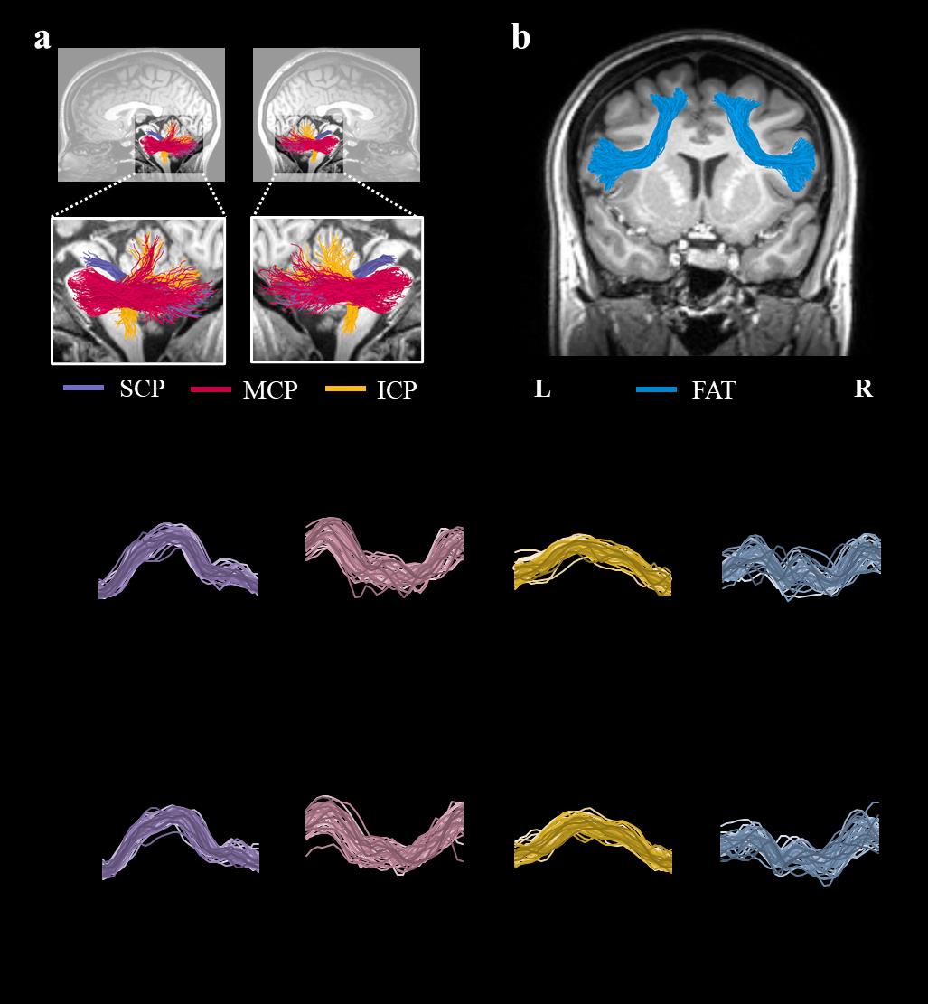 jossinger, S., Yablonski, METRO., amir, oh, & Ben-Shachar, METRO. (2023). The role of the cerebellum in language comprehension and image