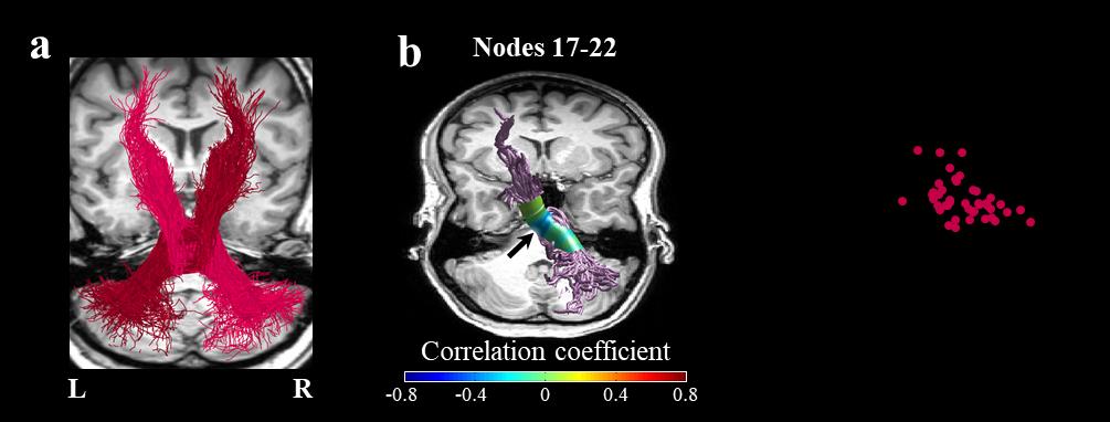 jossinger, S., Yablonski, METRO., amir, oh, & Ben-Shachar, METRO. (2023). The role of the cerebellum in language comprehension and image