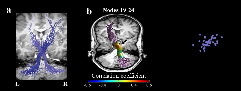 jossinger, S., Yablonski, METRO., amir, oh, & Ben-Shachar, METRO. (2023). The role of the cerebellum in language comprehension and image