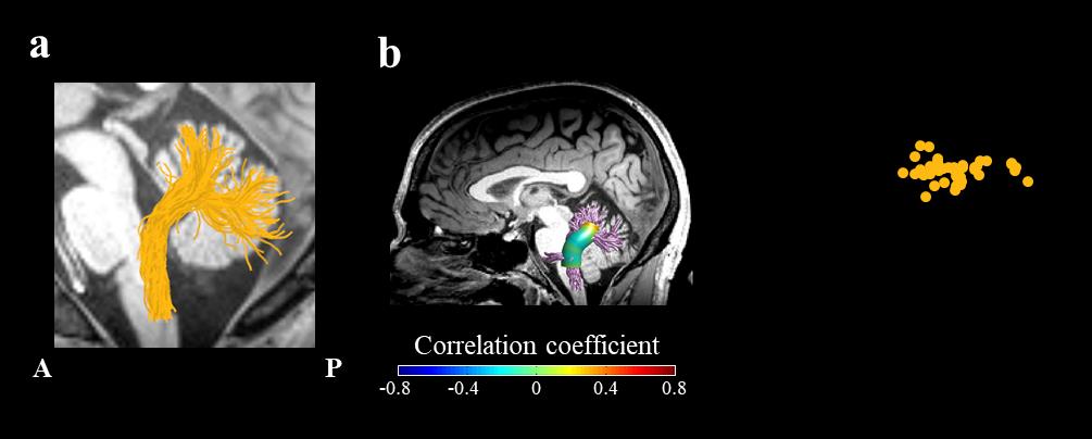 jossinger, S., Yablonski, METRO., amir, oh, & Ben-Shachar, METRO. (2023). The role of the cerebellum in language comprehension and image