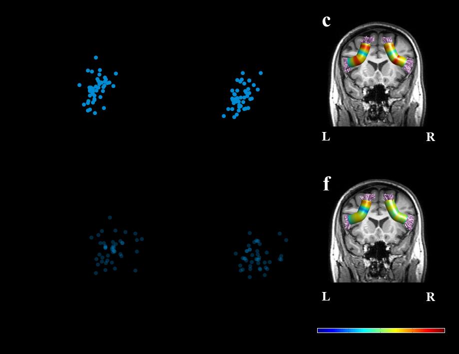 jossinger, S., Yablonski, METRO., amir, oh, & Ben-Shachar, METRO. (2023). The role of the cerebellum in language comprehension and image