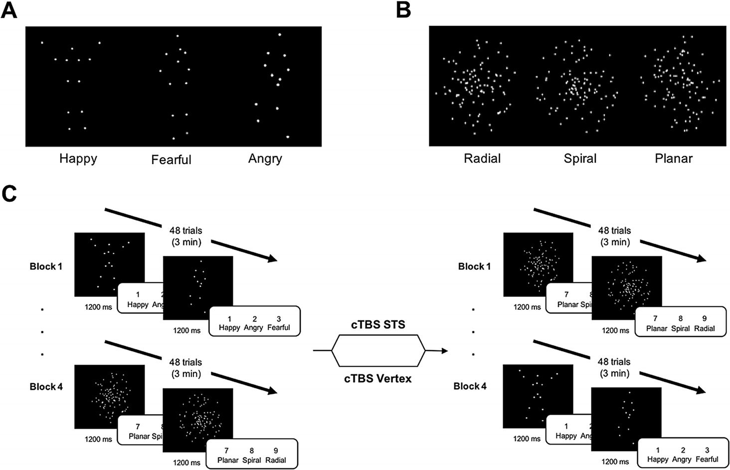 A Causal Role of the Right Superior Temporal image